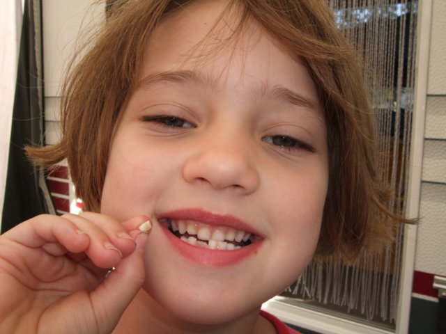 mijn1etandjeiseruit252009.jpg
